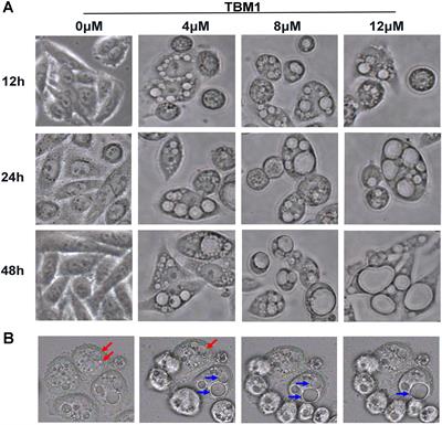 Tubeimoside 1 Acts as a Chemotherapeutic Synergist via Stimulating Macropinocytosis